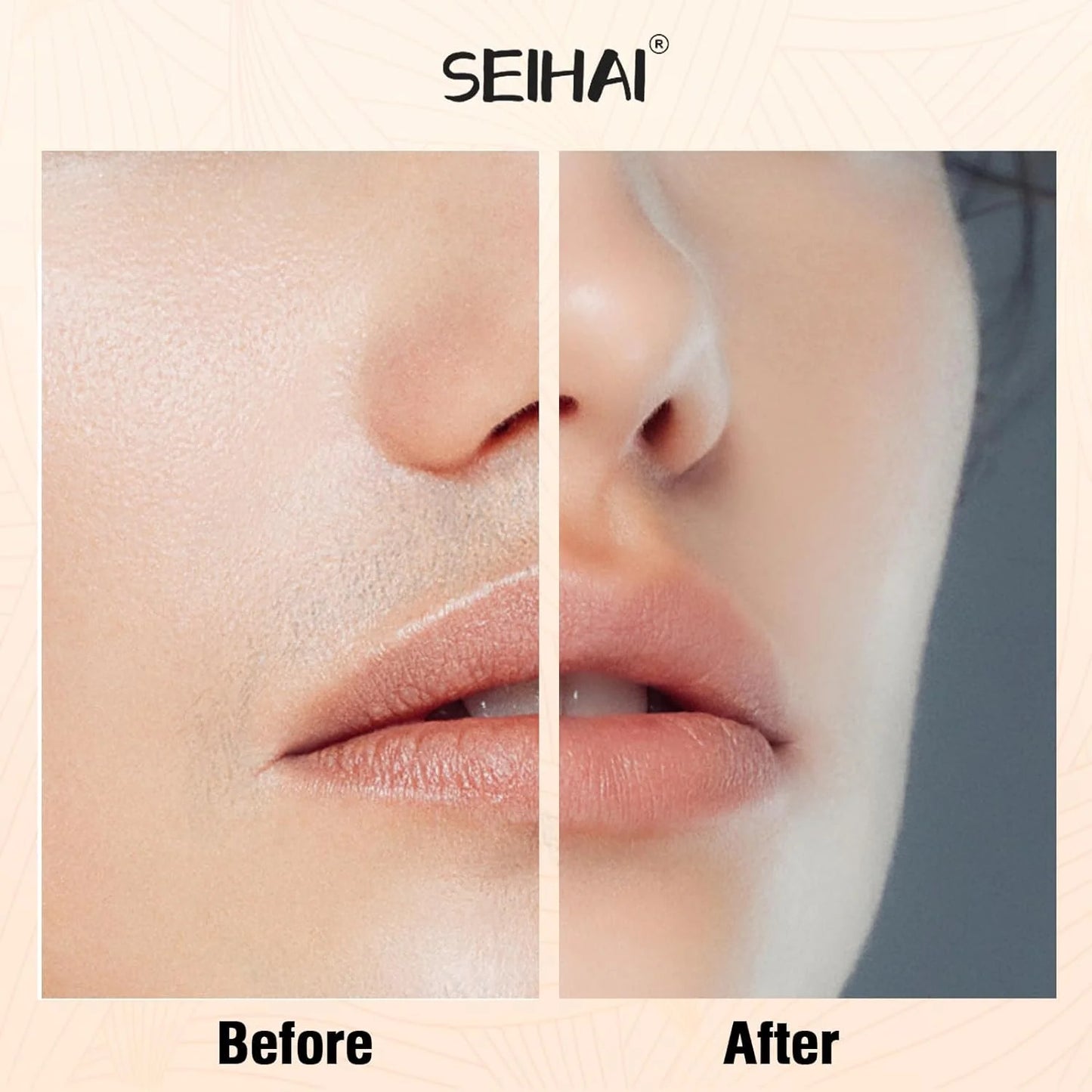 Facial Hair Removal
